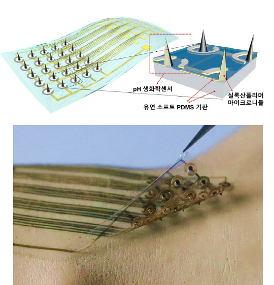 배병수 KAIST 교수 연구팀은 말초동맥질환을 진단할 수 있는 '웨어러블 마이크로니들 센서'를 개발했다. 사진은 마이크로니들 생화학 센서를 피부에 부착한 모습. KAIST 제공
